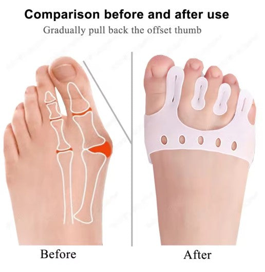 Comfort Gel Toe Separators